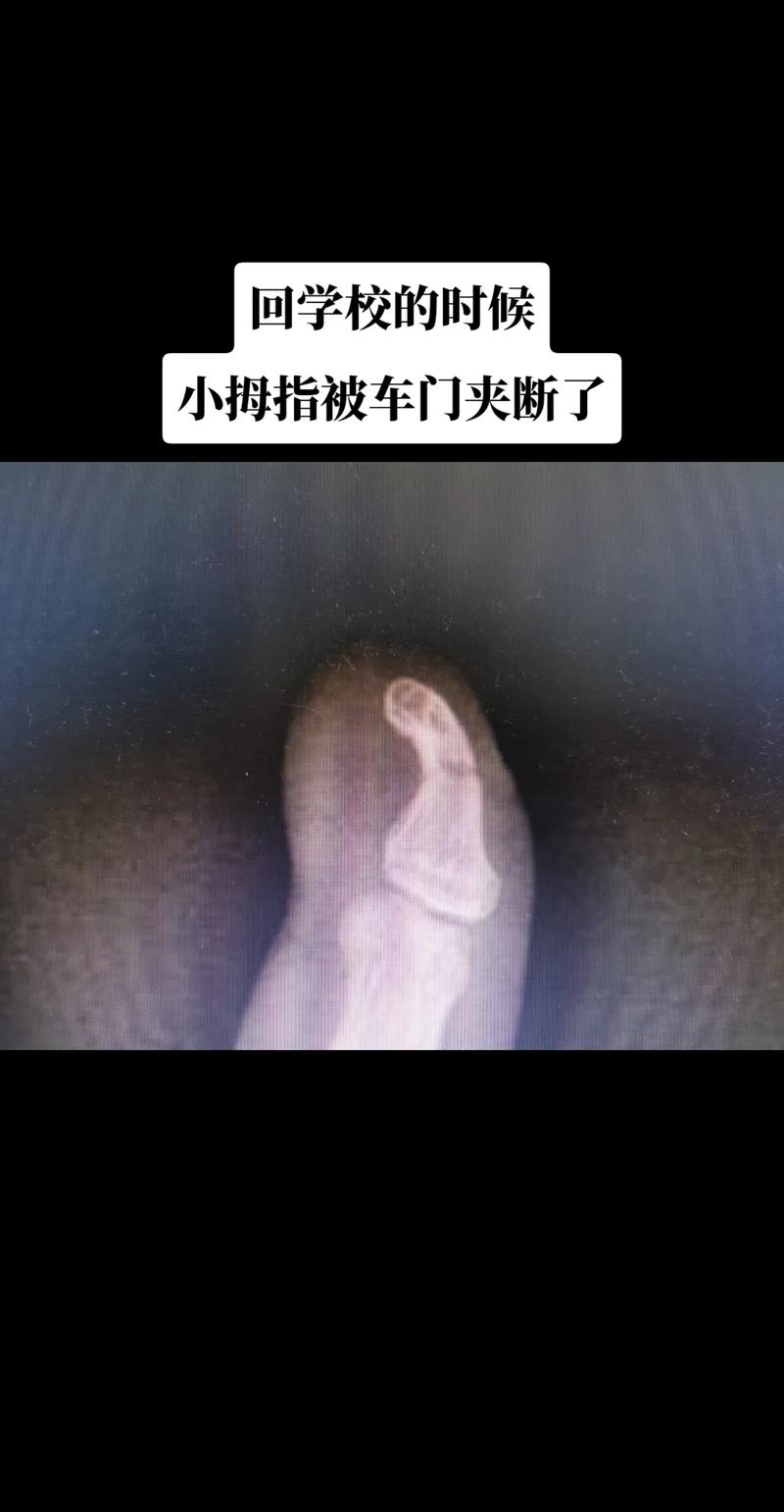 行李箱里的少女白尘死了吗